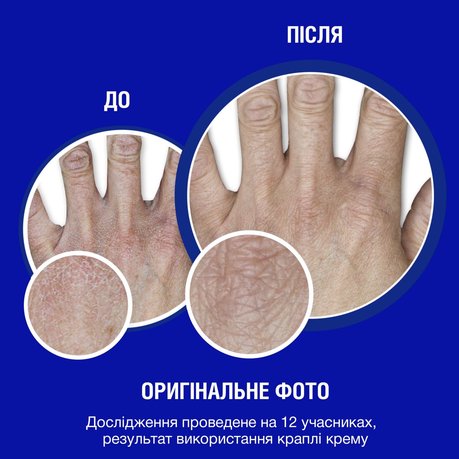 Neutrogena Крем для рук без запаху"Норвезька формула" концентрований 50млфото