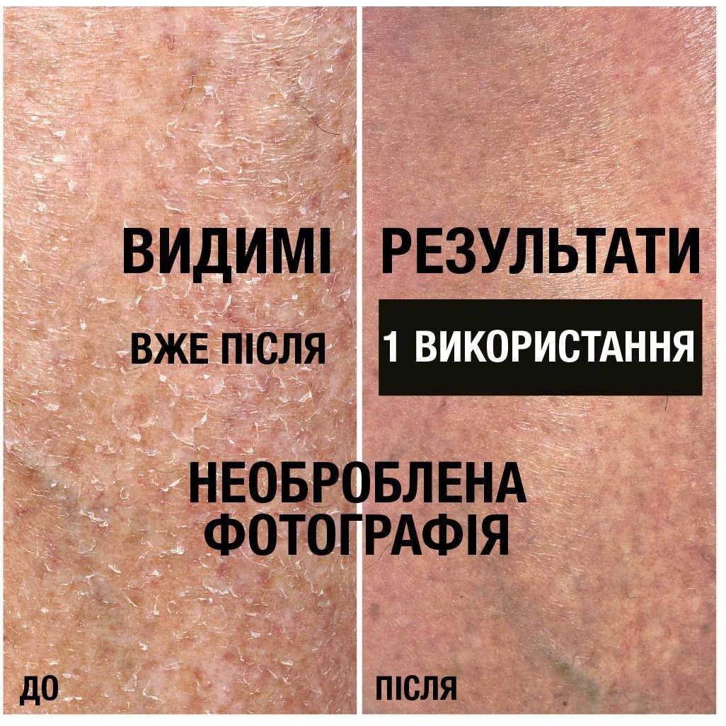 Лосьон для тела Neutrogena Норвежская формула Интенсивное восстановление 250мл фото