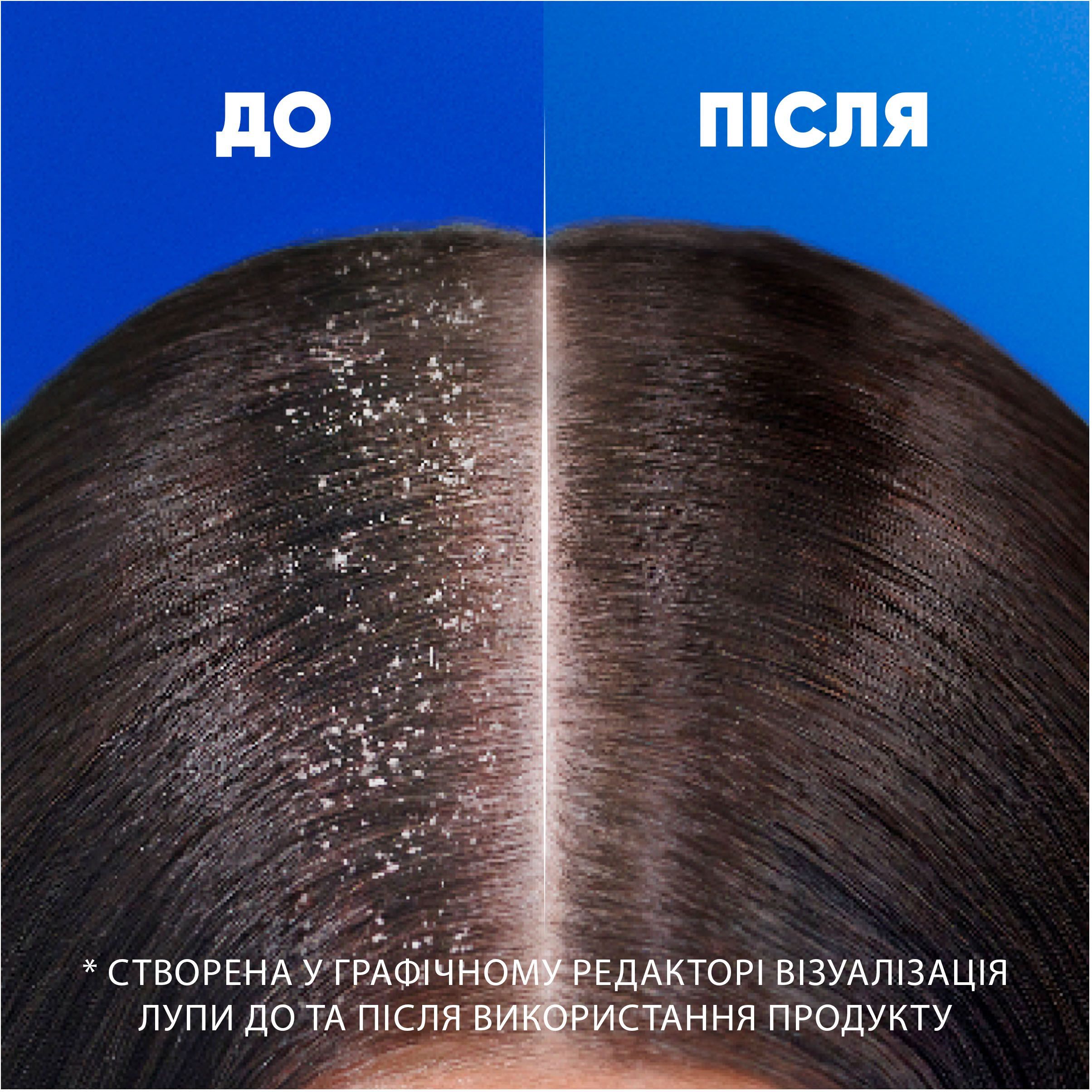 Шампунь против перхоти Head & Shoulders Успокаивающий уход 400 мл фото 4