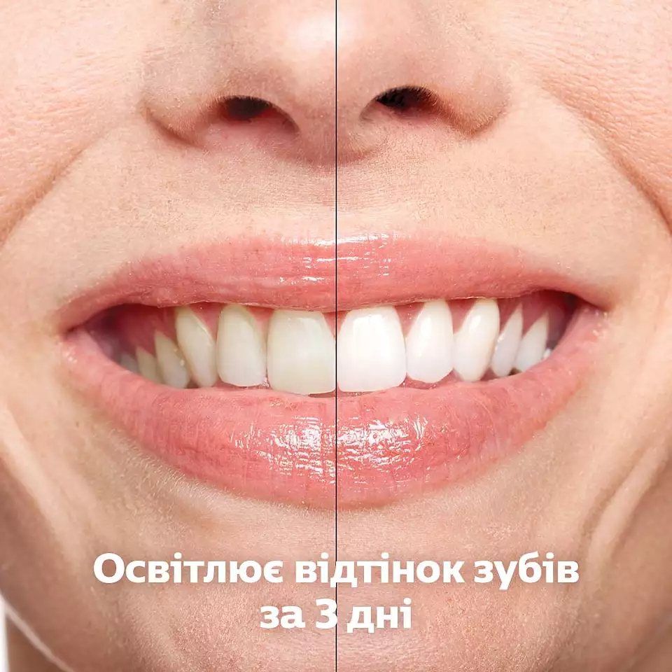 Набор электрических зубных щеток Philips Sonicare Diamond Clean 9000 HX9914/69 фото 8
