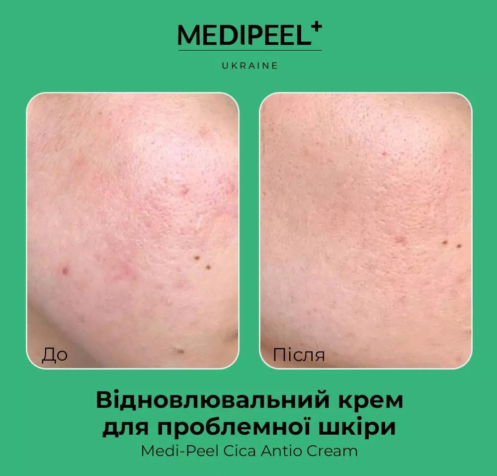 Крем для проблемної шкіри Medi-peel Cica Antio Cream відновлювальний 30млфото5