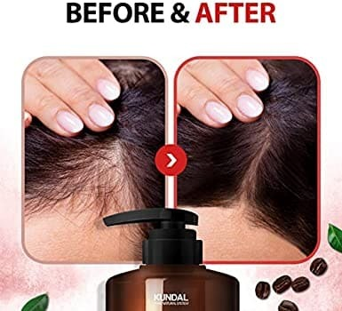 Шампунь Kundal Natural Caffeine&amp;Intrnsive Scalp Care Shampoo White Musk проти випадіння волосся 500 млфото