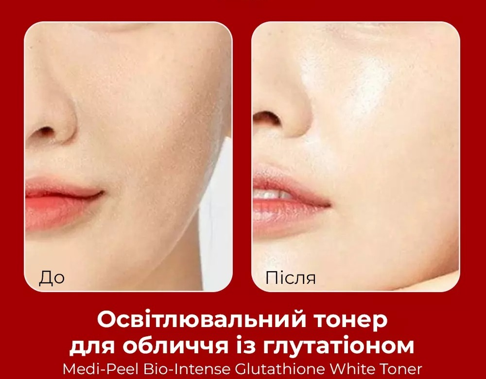 Тонер Medi-Peel Bio Intense Glutathione White Silky осветляющий с глутатионом 180 мл фото 10