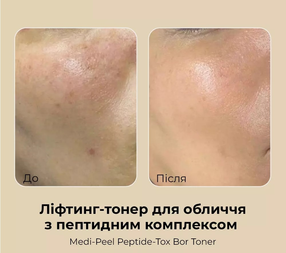 Тонер для лица Medi-Peel Peptide-Tox Bor пептидный 180 мл фото 9