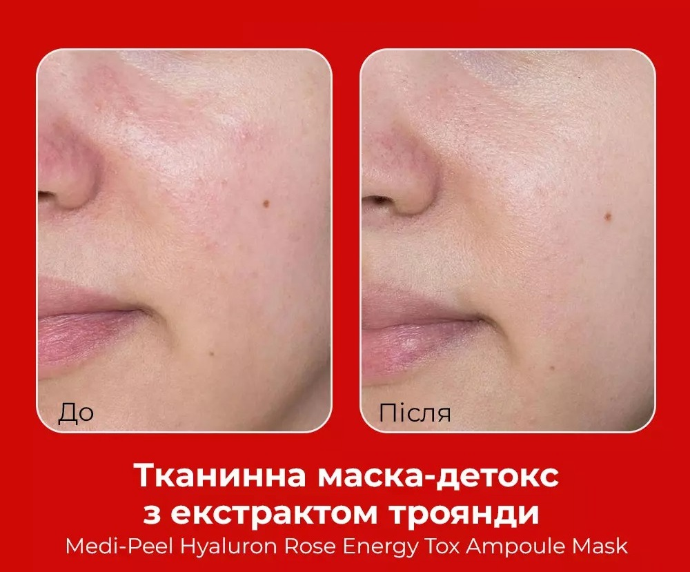 Тканевая маска для лица Medi-Peel Hyaluron Rose Energy Tox Ampoule Mask 30 мл фото 7