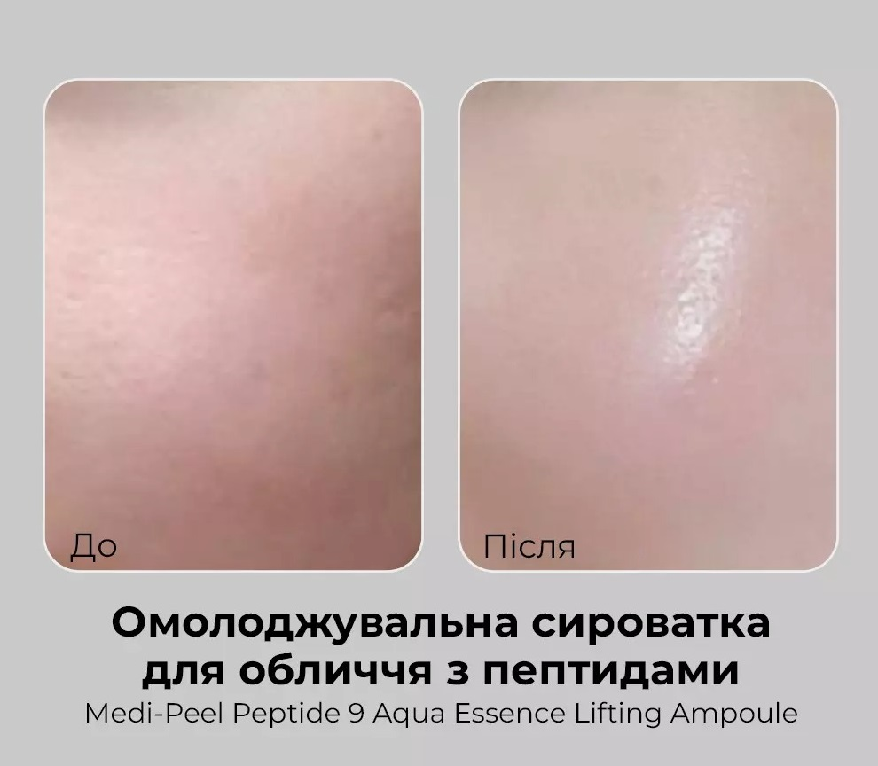 Сыворотка Medi-Peel Peptide 9 Aqua Essence антиоксидантный лифтинг с пептидами 50 мл фото 6