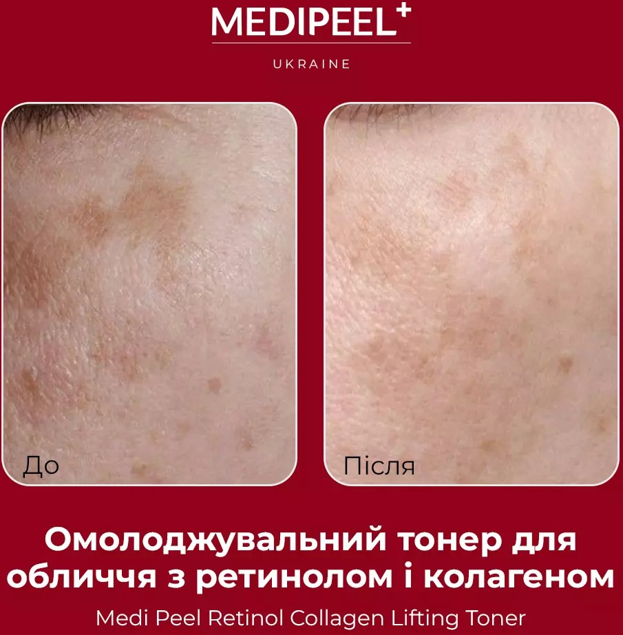 Тонер Medi-peel Retinol Collagen Lifting 150 млфото3