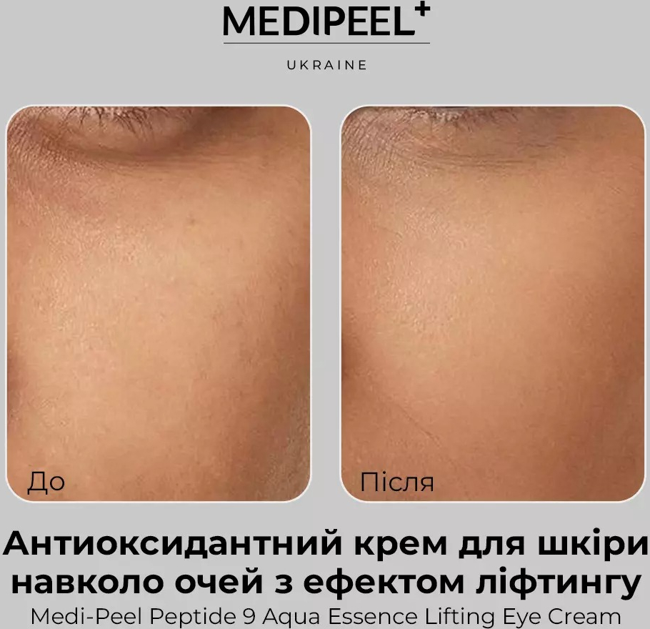 Крем для зони навколо очей Medi-peel Peptide 9 Aqua Essence Lifting 40 млфото