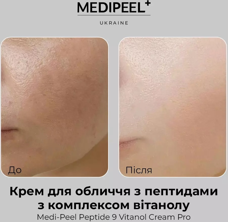 Крем для обличчя Medi-peel Peptide 9 Vitanol 50 млфото