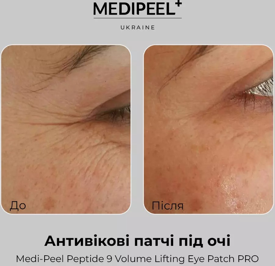 Гідрогелеві патчі Medi-peel Peptide 9 Volume Lifting 60 штфото3