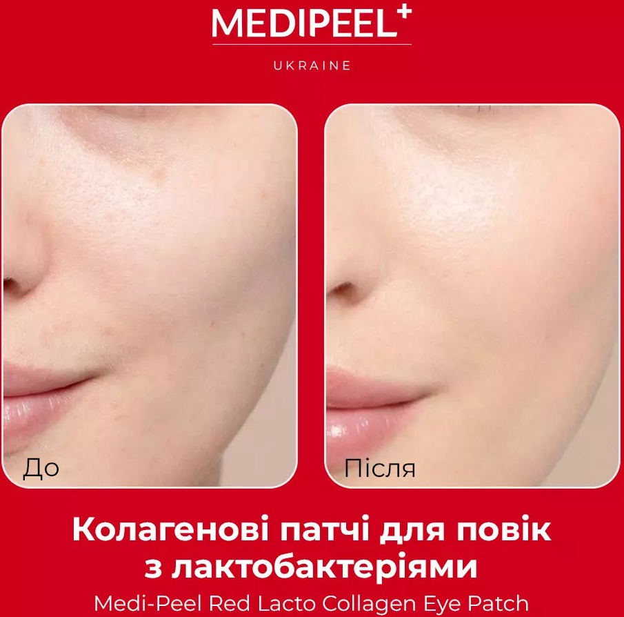 Патчи для глаз Medi-Peel Red Lacto Collagen 60 шт фото