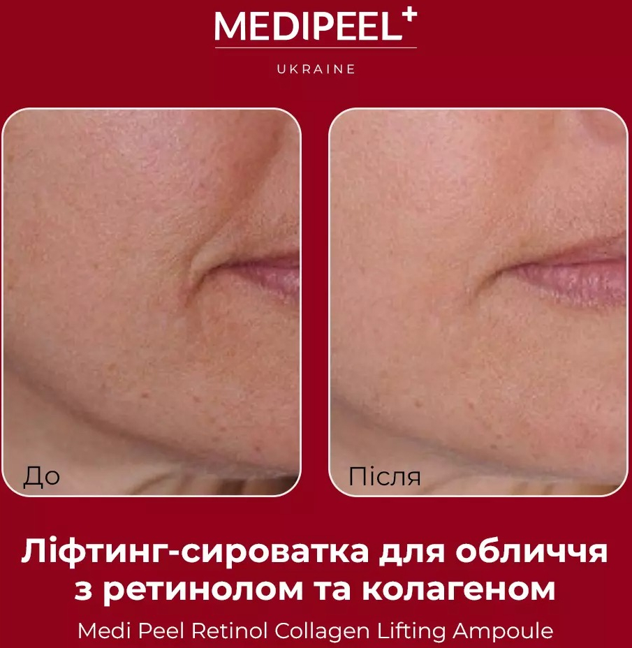Сыворотка для лица Medi-Peel Retinol Collagen Lifting 50 мл фото 4