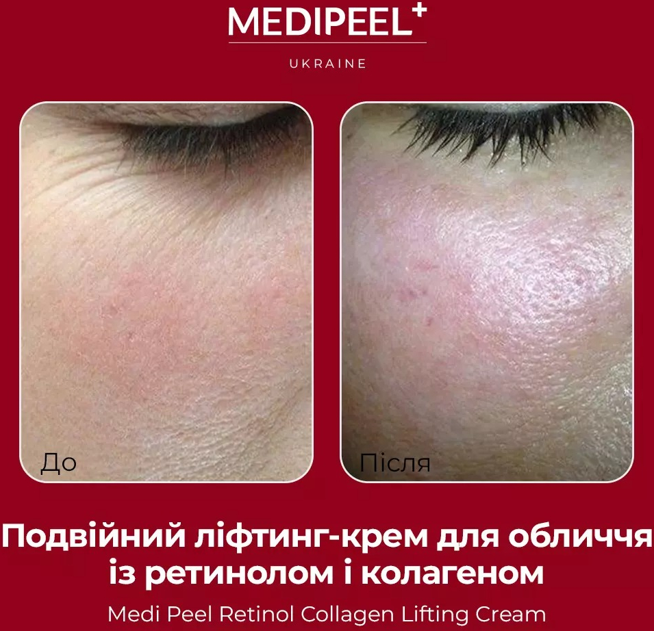Крем для обличчя Medi-peel Retinol Collagen Lifting 50 млфото4