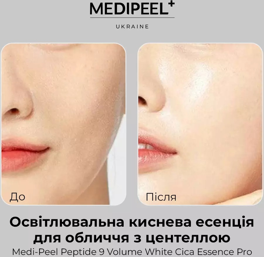 Освітлювальна киснева есенція для обличчя з центеллою MEDI-PEEL Peptide 9 Volume White Cica Essence Pro 100 млфото