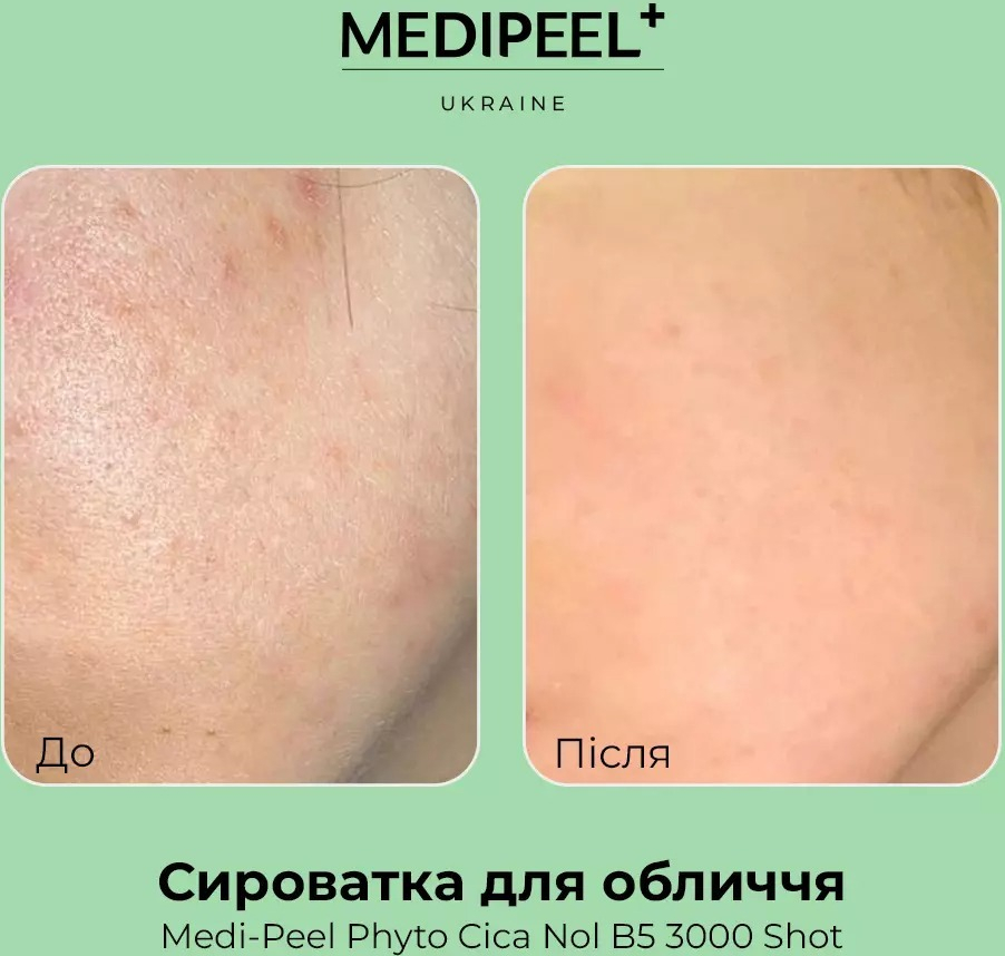 Заспокійлива сироватка для чутливої та проблемної шкіри MEDI-PEEL Phyto Cica Nol B5 3000 Shot 50 млфото