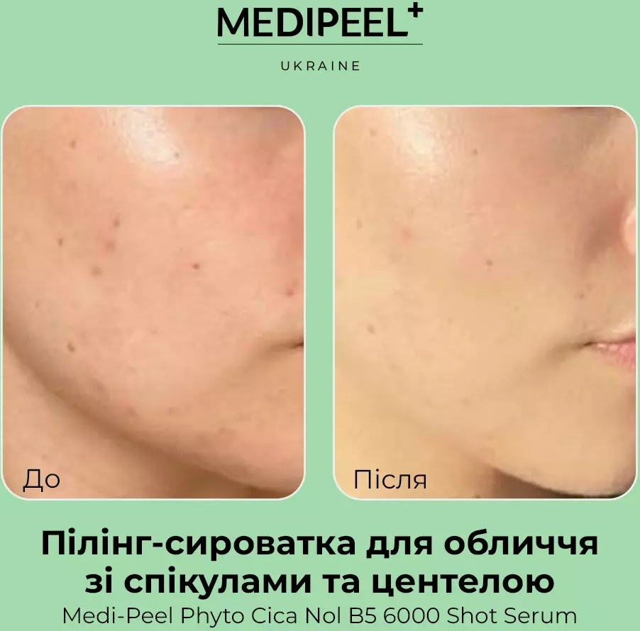 Пілінг-сироватка для чутливої та проблемної шкіри MEDI-PEEL Phyto Cica Nol B5 6000 Shot 50 млфото