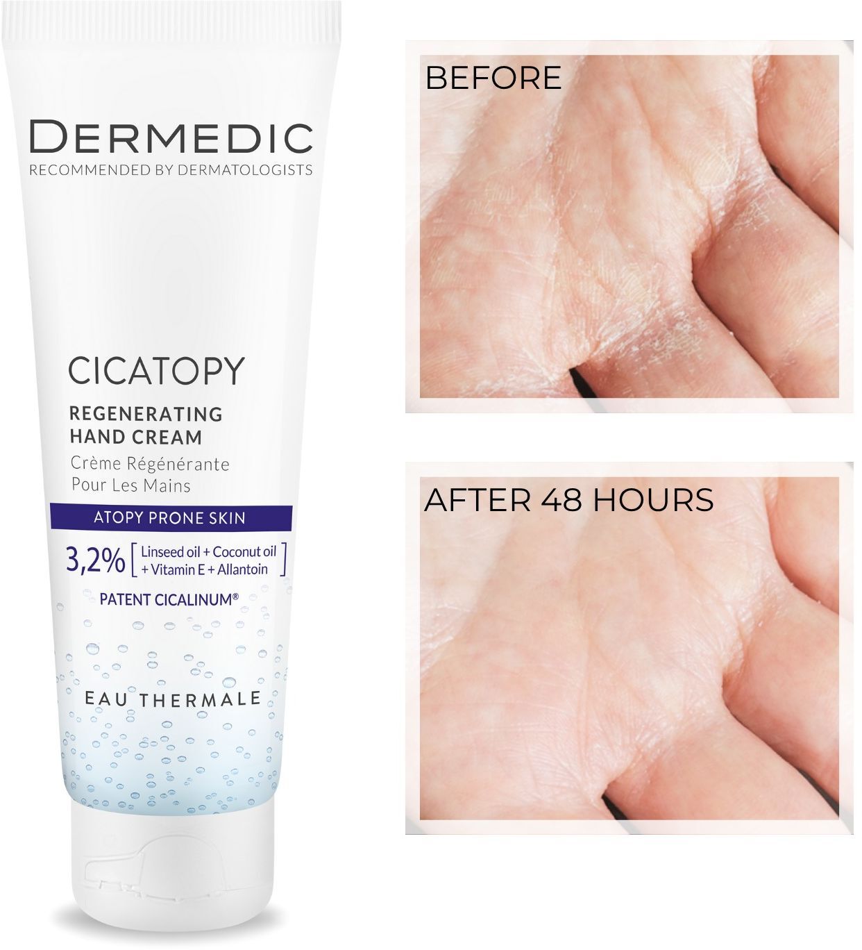 Крем для рук Dermedic Cicatopy відновлюючий 75 млфото2