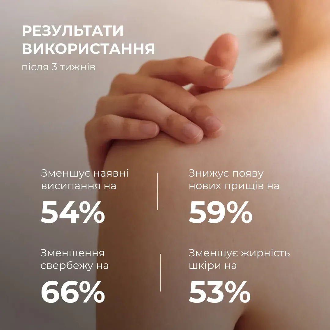 Гель для тіла очищувальний Hillary Anti-Acne Salicylic Body Wash з саліциловою кислотою 200 млфото