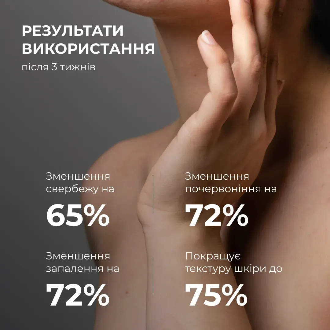 Лосьон-детокс для проблемной кожи Hillary Anti-Acne Salicylic Body Lotion с салициловой кислотой 150 мл фото 3