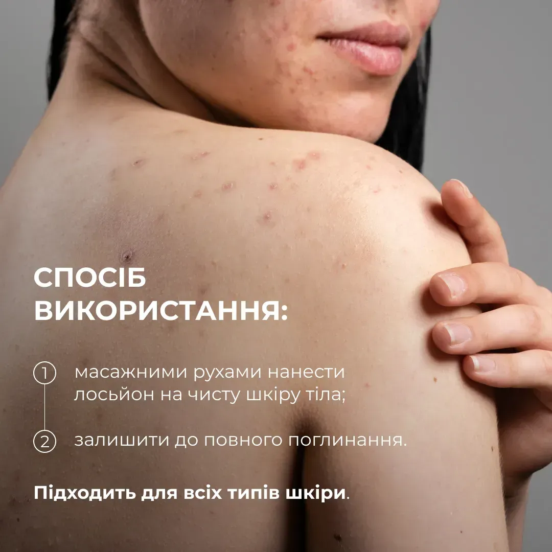 Лосьон-детокс для проблемной кожи Hillary Anti-Acne Salicylic Body Lotion с салициловой кислотой 150 мл фото 6