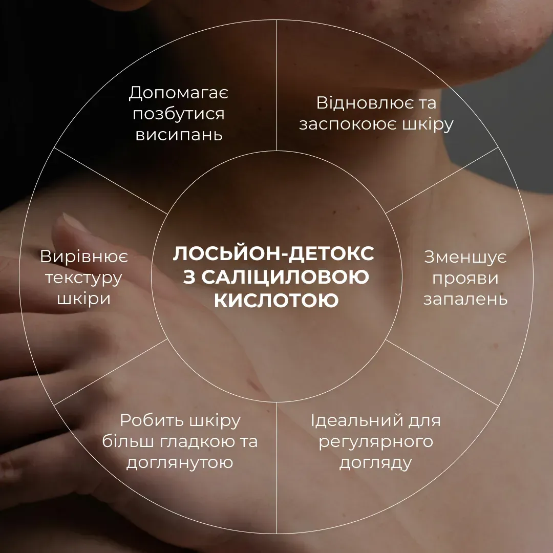 Лосьон-детокс для проблемной кожи Hillary Anti-Acne Salicylic Body Lotion с салициловой кислотой 150 мл фото 8