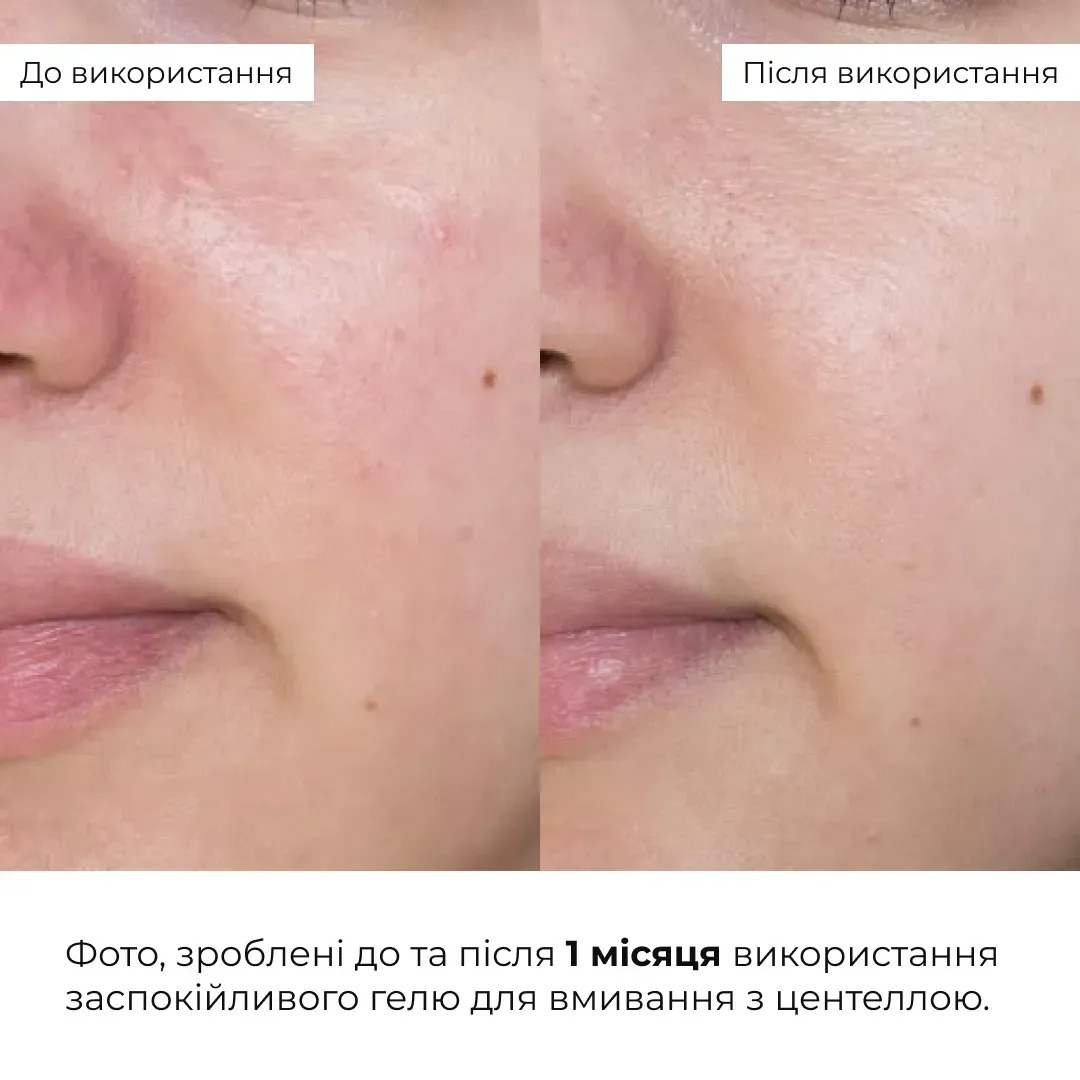 Гель для умывания Hillary Centella Soothing Cleansing Gel Успокаивающий с центеллой 100 мл фото 3