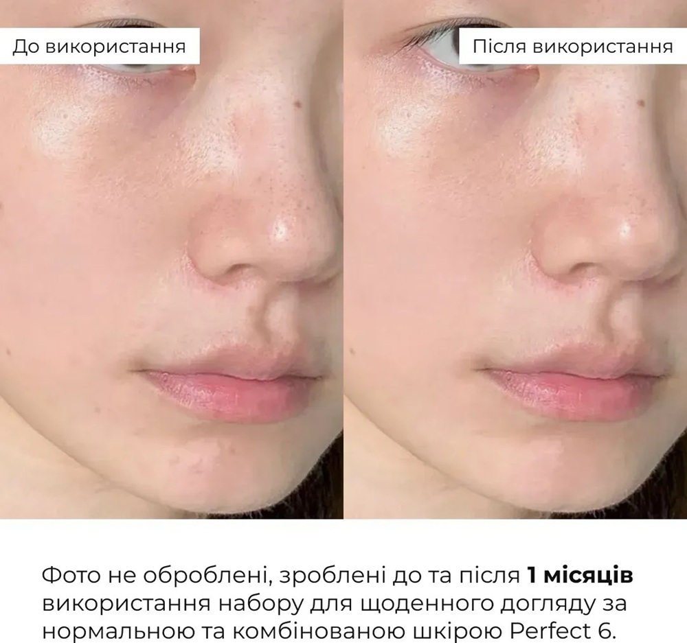 Набор Hillary Perfect 6 для ежедневного ухода за нормальной и комбинированной кожей фото 10