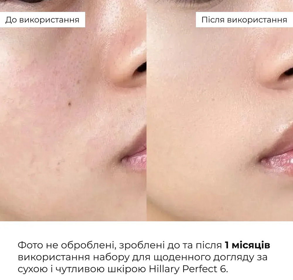 Набор Hillary Perfect 6 для ежедневного ухода за сухой и чувствительной кожей фото 10
