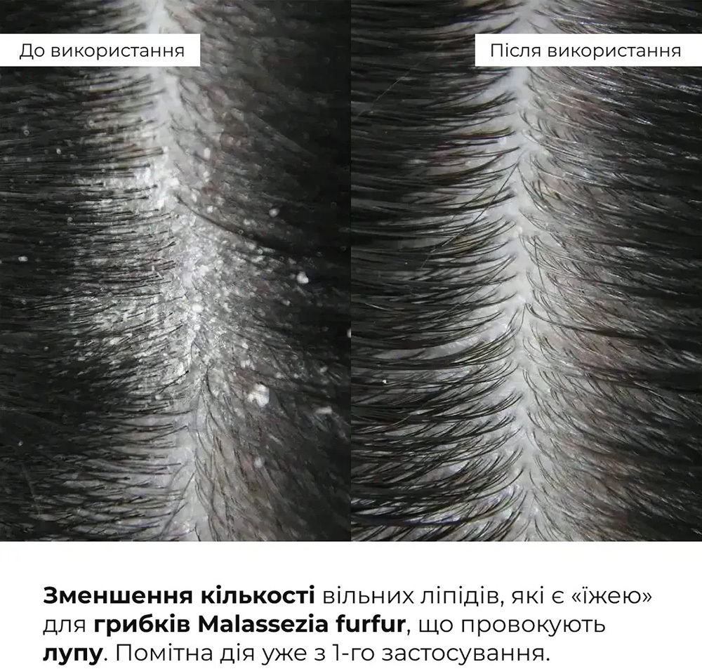 Комплекс Hillary Perfect Care Hair Nori для всех типов волос фото 