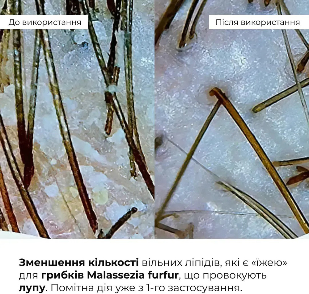 Комплекс Hillary Perfect Care Hair Nori для всех типов волос фото 