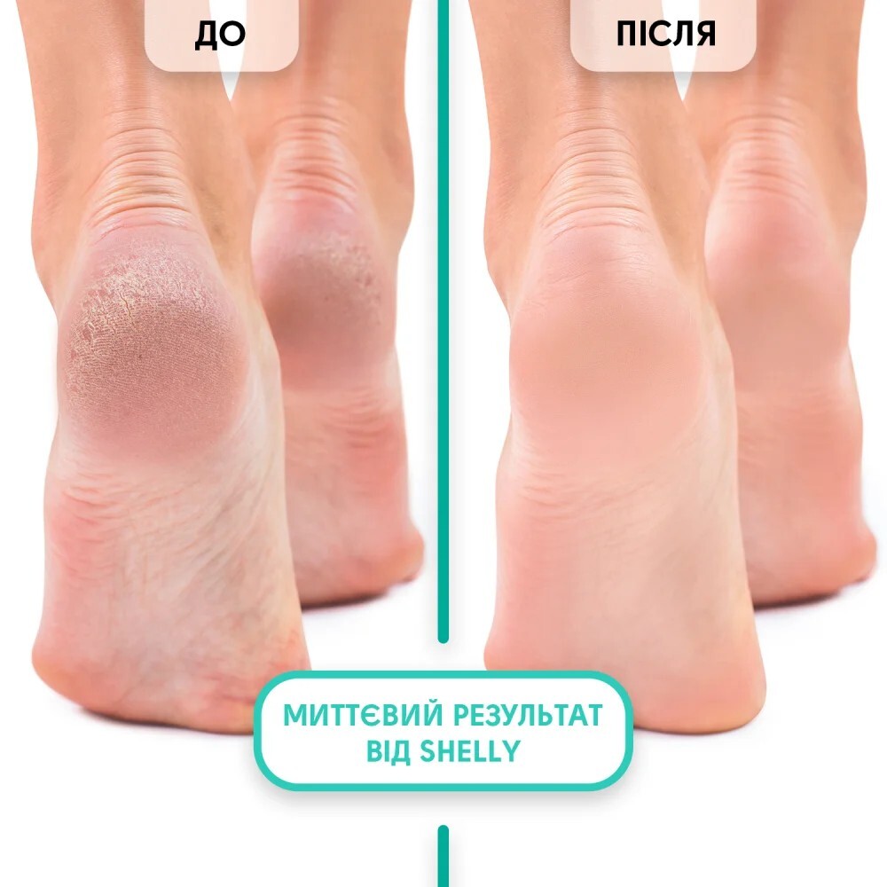Пенный экспресс-размягчитель для педикюра Shelly Мягкое лезвие 150 мл фото 