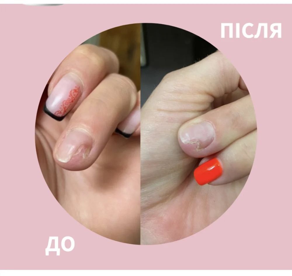 Масло при повреждении ногтевой пластины Shelly Стоп Онихолихис 30 мл фото 