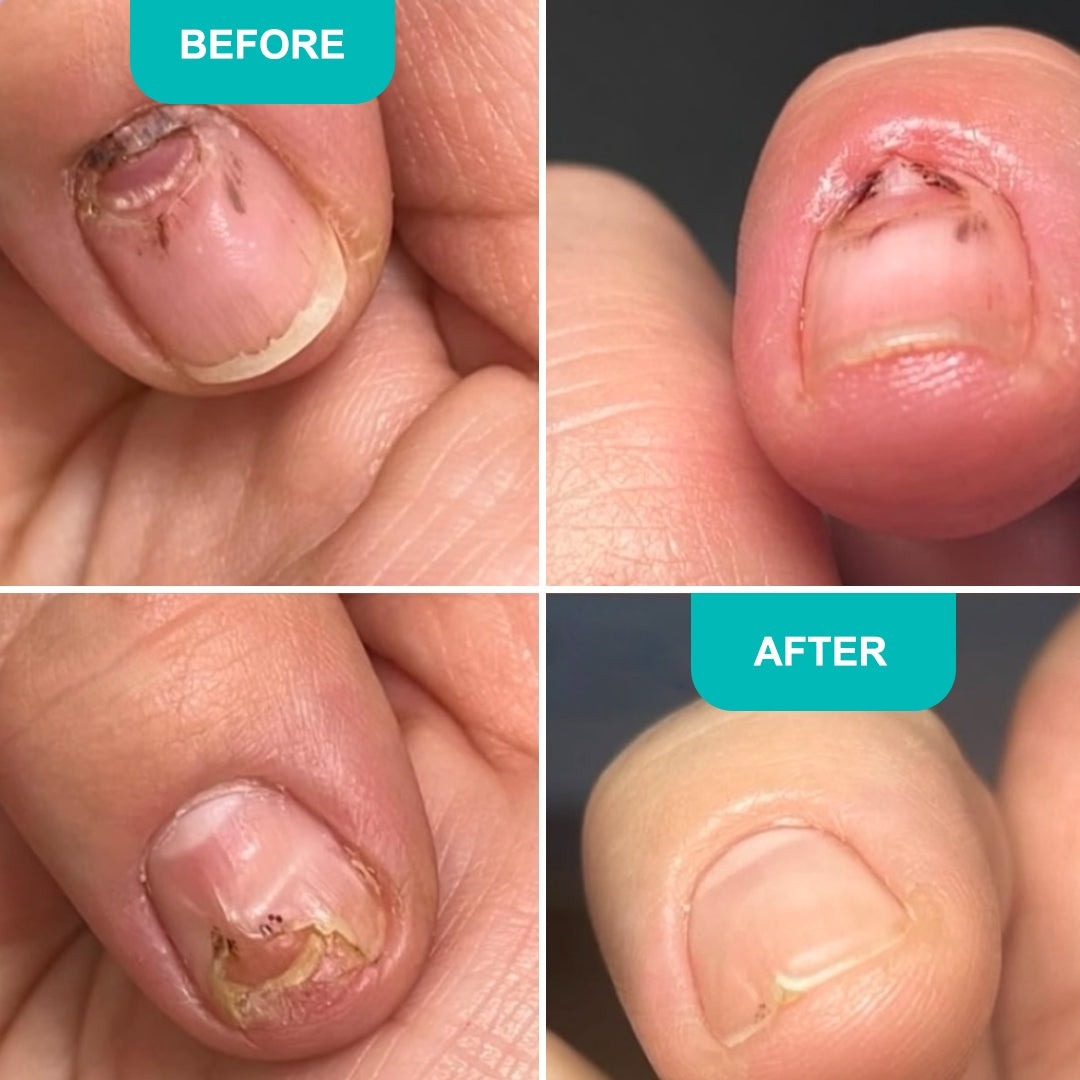 Відновлююча олія для ослаблених нігтів Shelly з фарнезолом 30 млфото