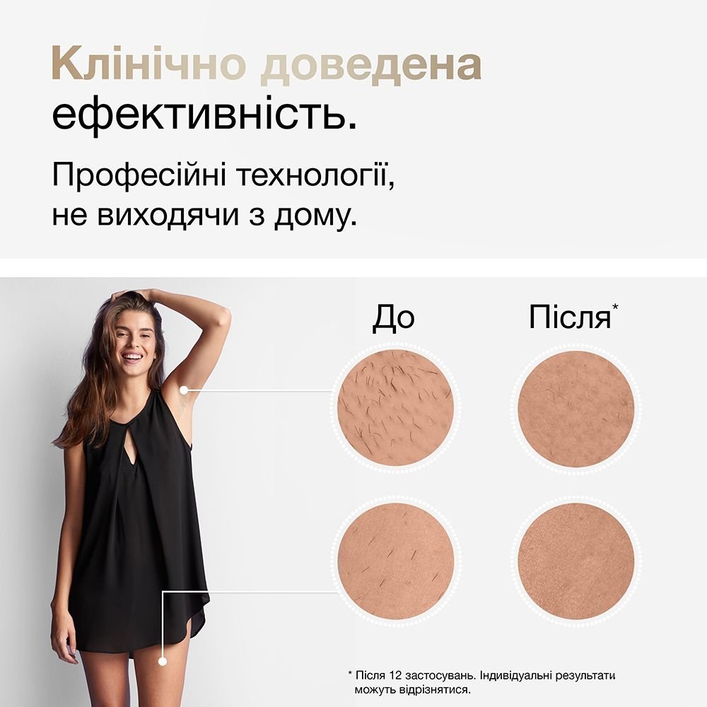 Фотоепілятор Braun Silk-expert Pro 5 IPL PL 5146фото