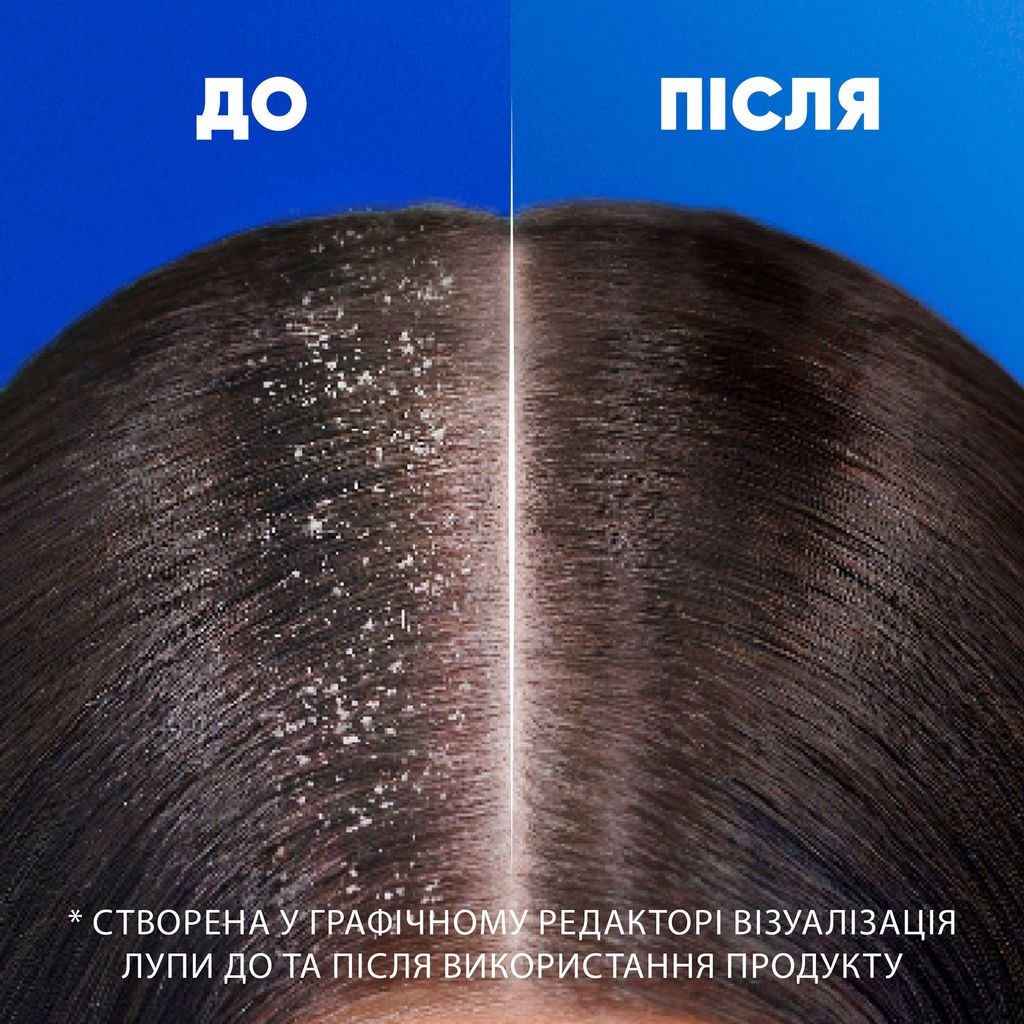 Шампунь проти лупи Head &amp; Shoulders Глибоке зволоження 625 млфото