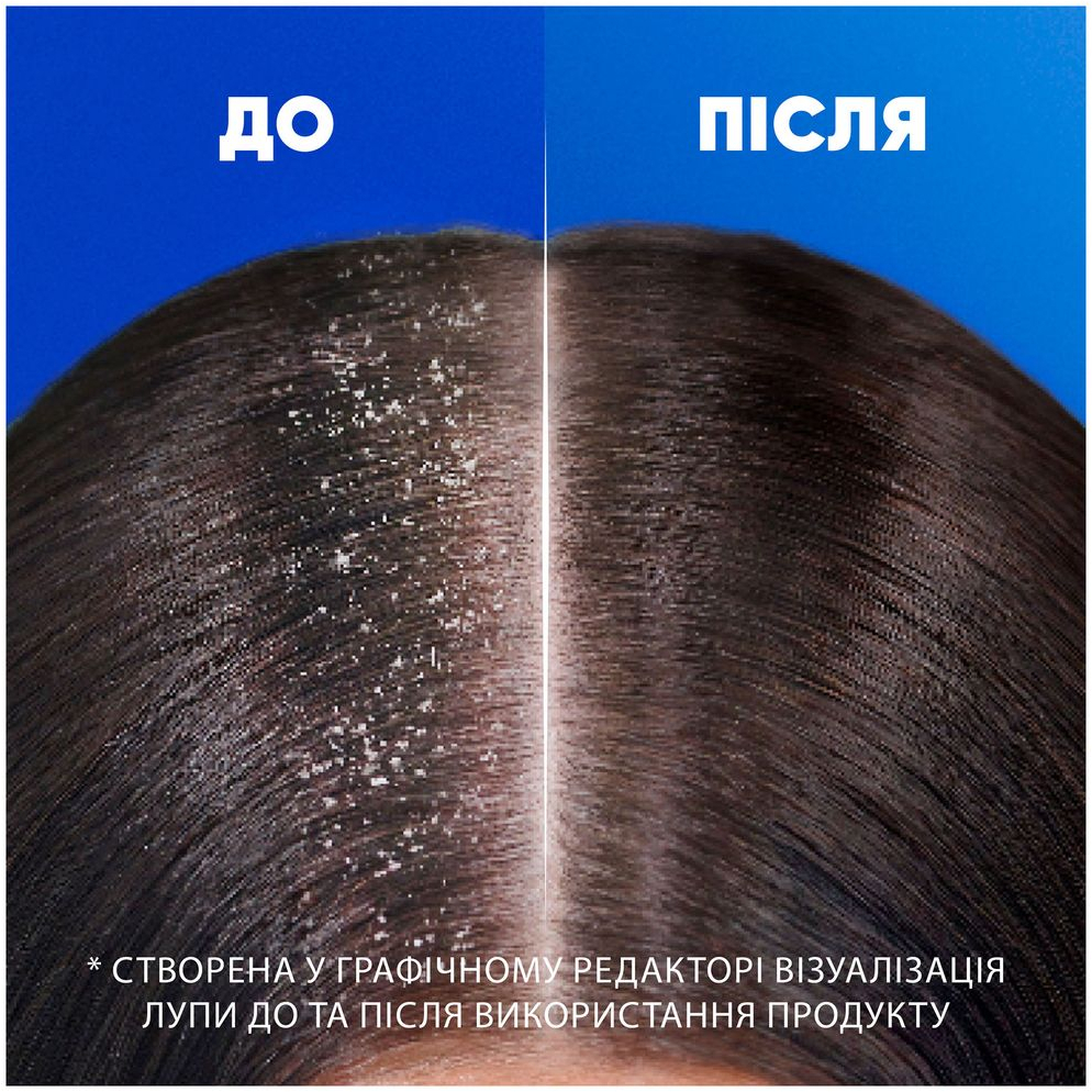 Шампунь та бальзам-ополіскувач проти лупи Head &amp; Shoulders 2в1 Цитрусова свіжість 800 млфото