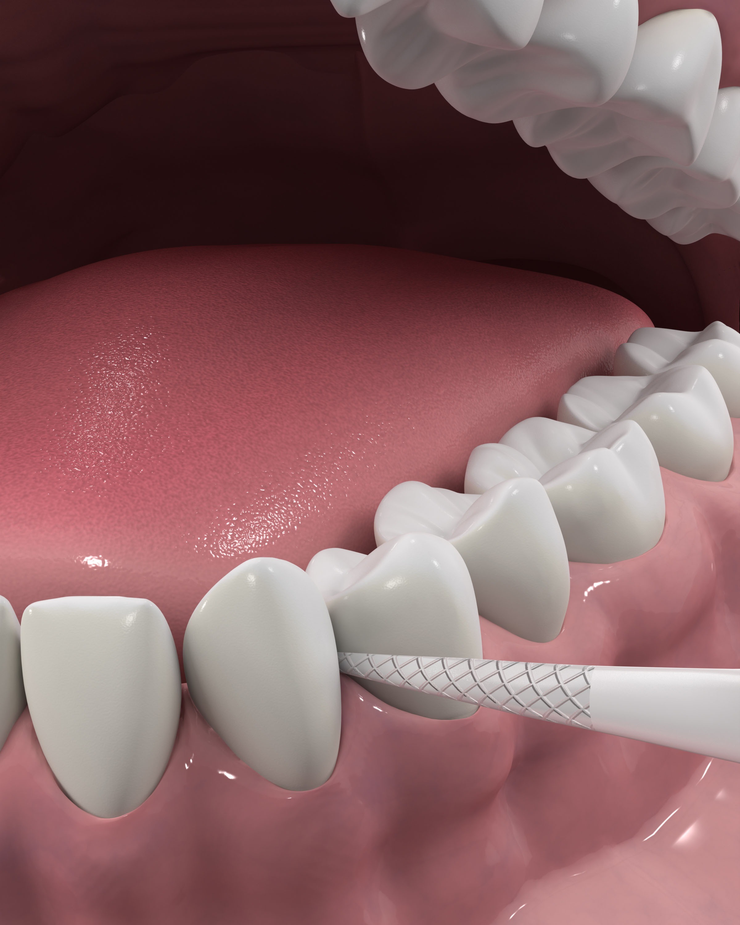 Флос-зубочистки DenTek Triple Clean потрійне очищення 150 штфото