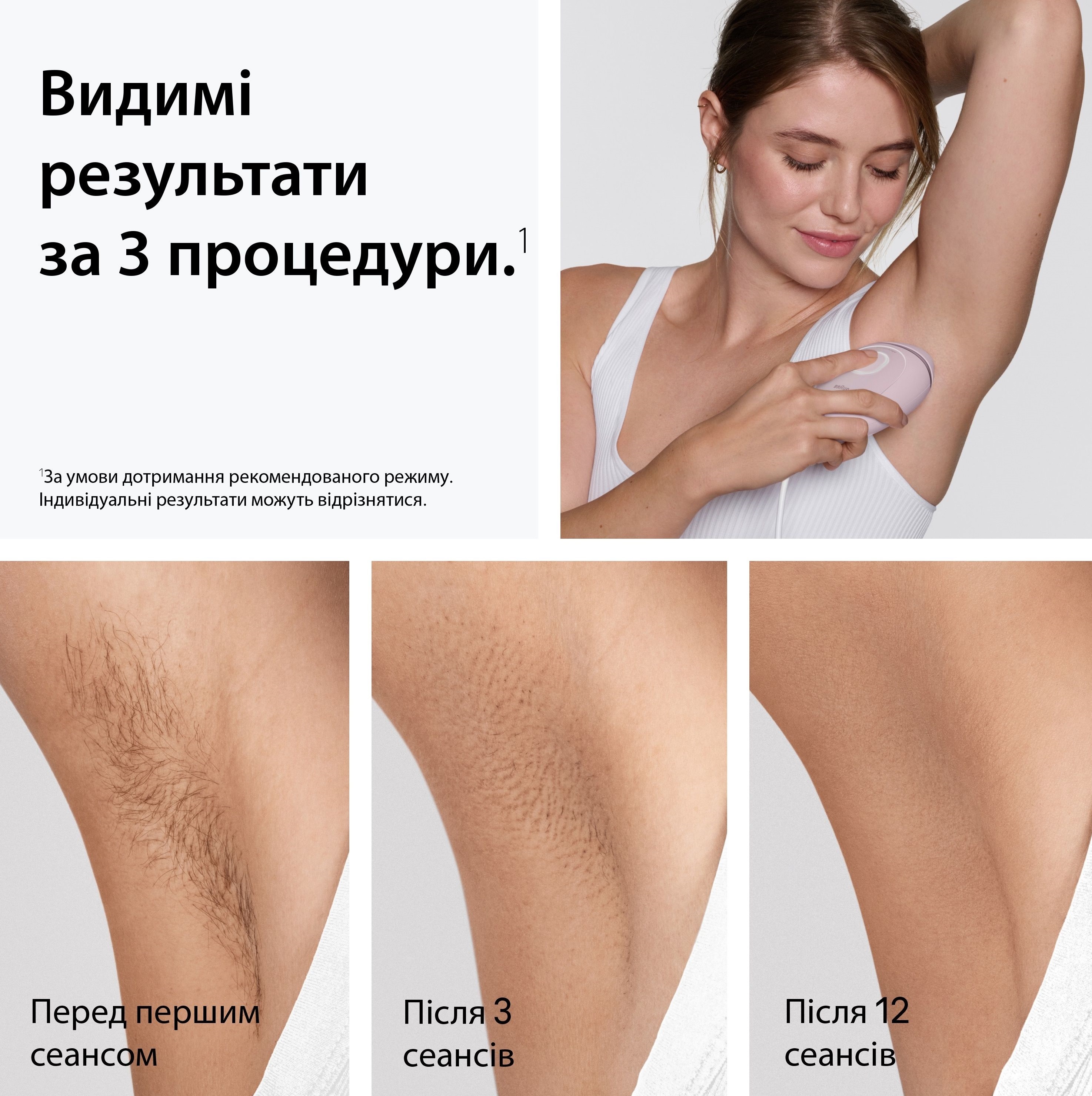 Фотоэпилятор Braun PL1111+GIL Venus фото 