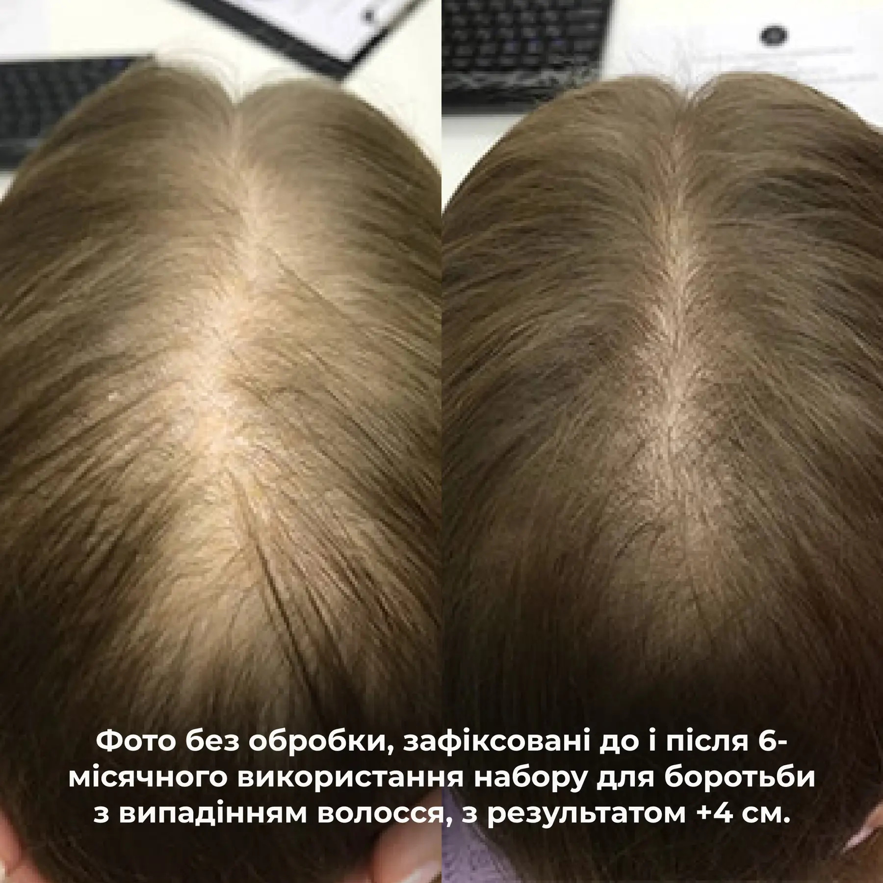 Маска Hillary Serenoa &amp; РР Hair Loss Control против выпадения волос 200 мл фото