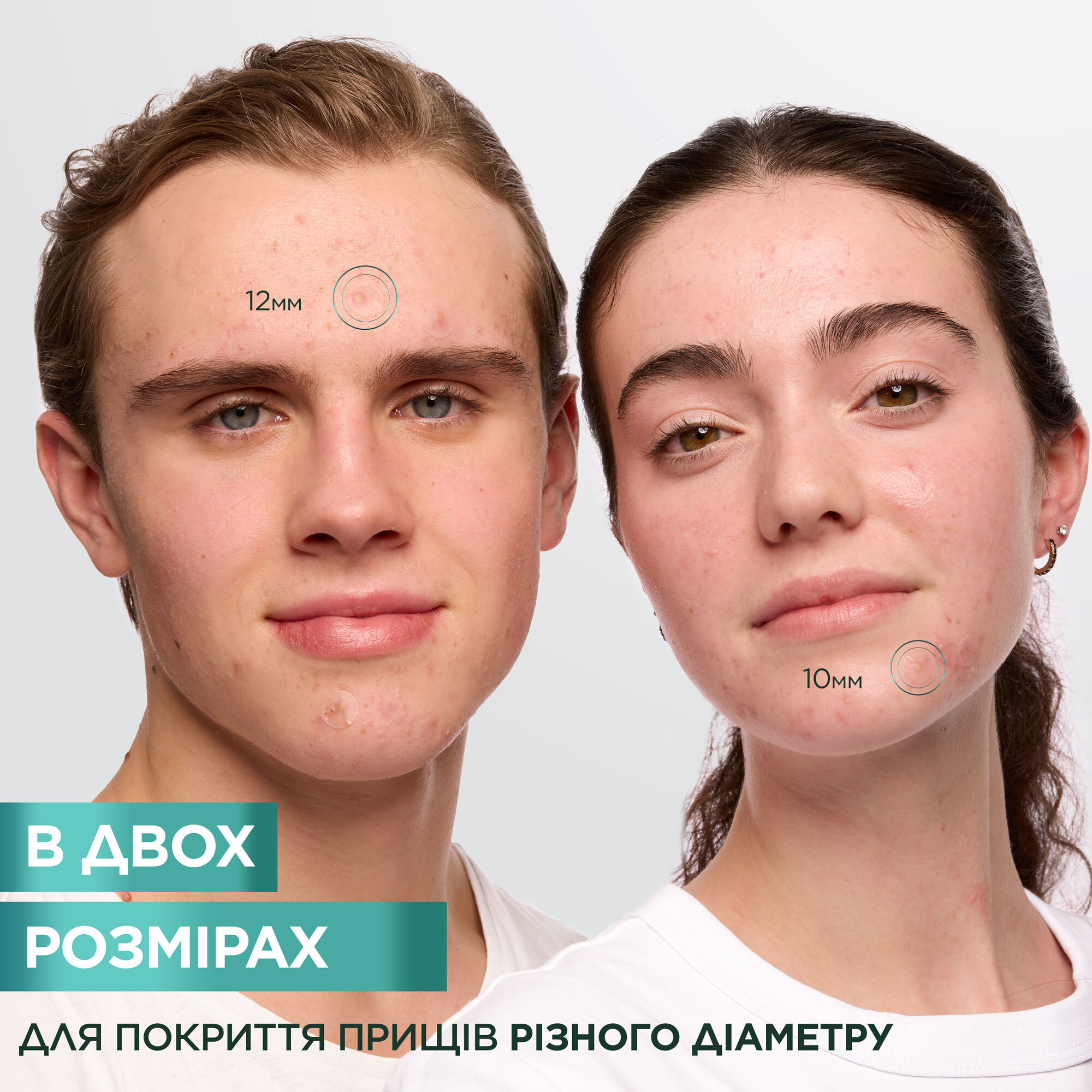 Гідроколоїдні патчі проти прищів Garnier Пюр Актив 22 шт. фото4