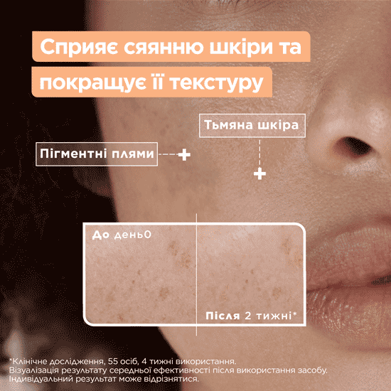 Сыворотка Mixa для сияния тусклой чувствительной кожи лица 30 мл фото3