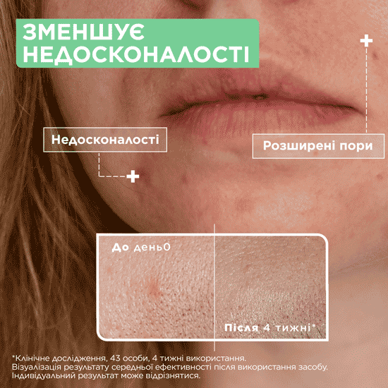 Сыворотка Mixa для проблемной чувствительной кожи лица 30 мл фото4