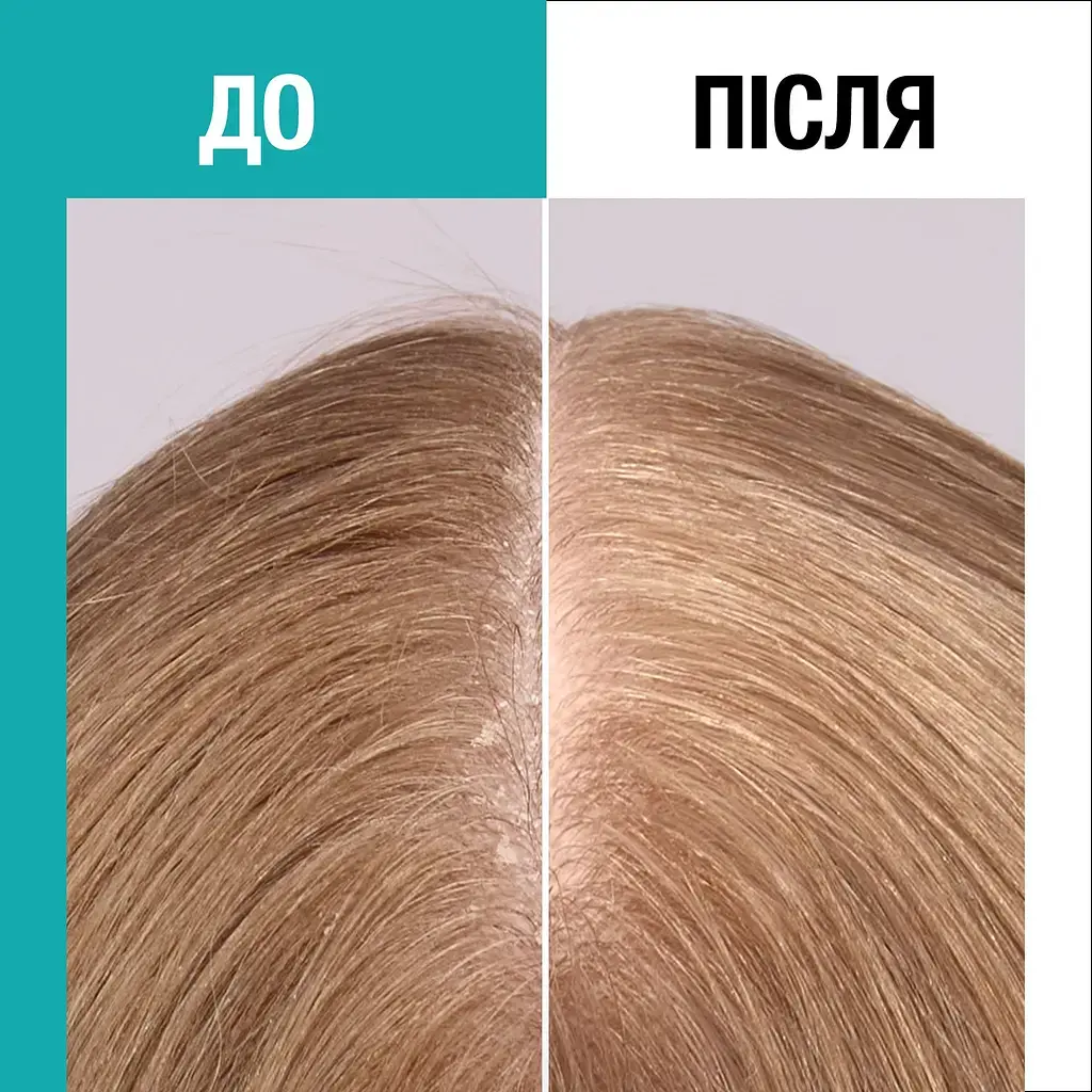 Зволожувальна сироватка Gliss Scalp Balance 100 мл фото9