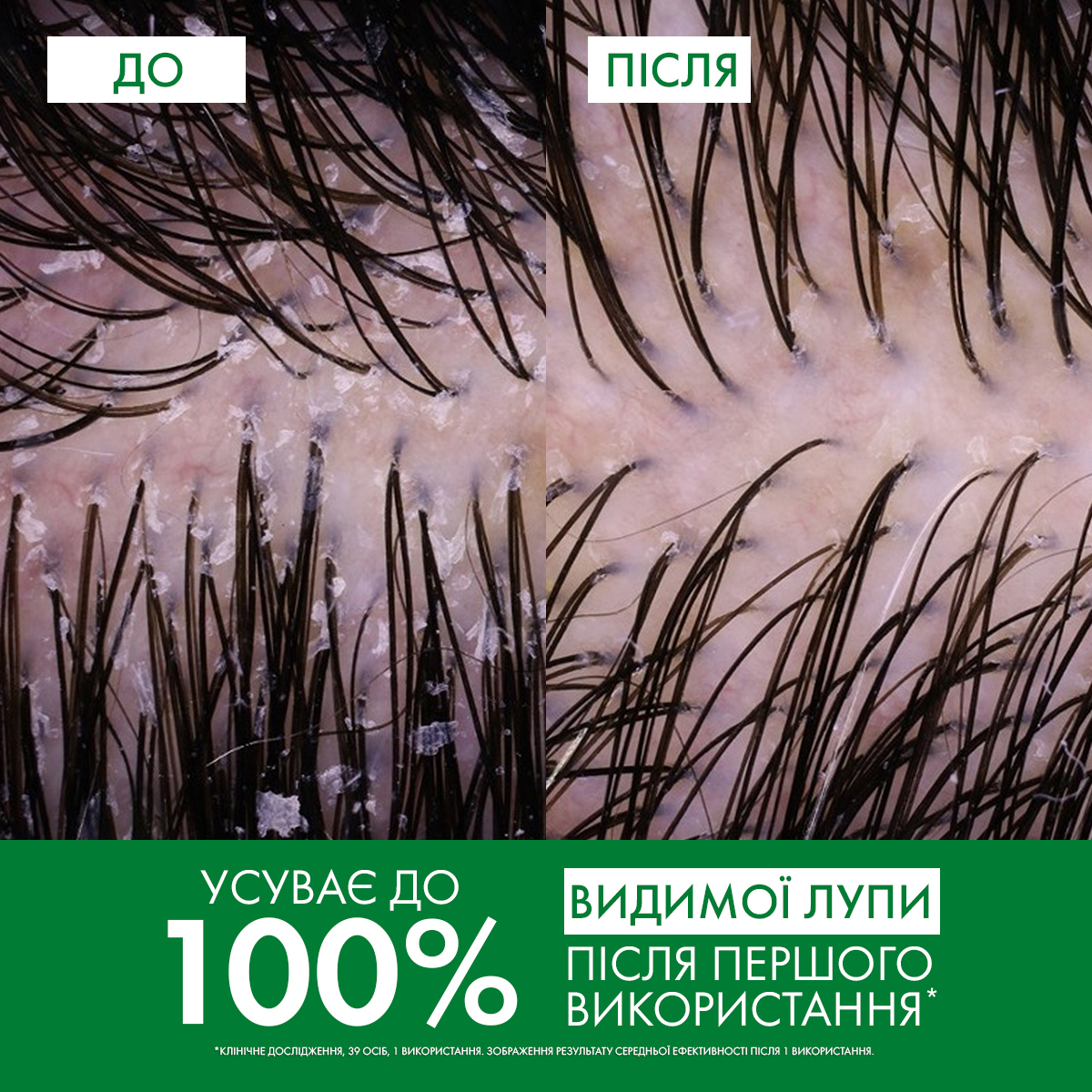 Шампунь Vichy Dercos против перхоти для сухих волос 200 мл (M0362921) фото