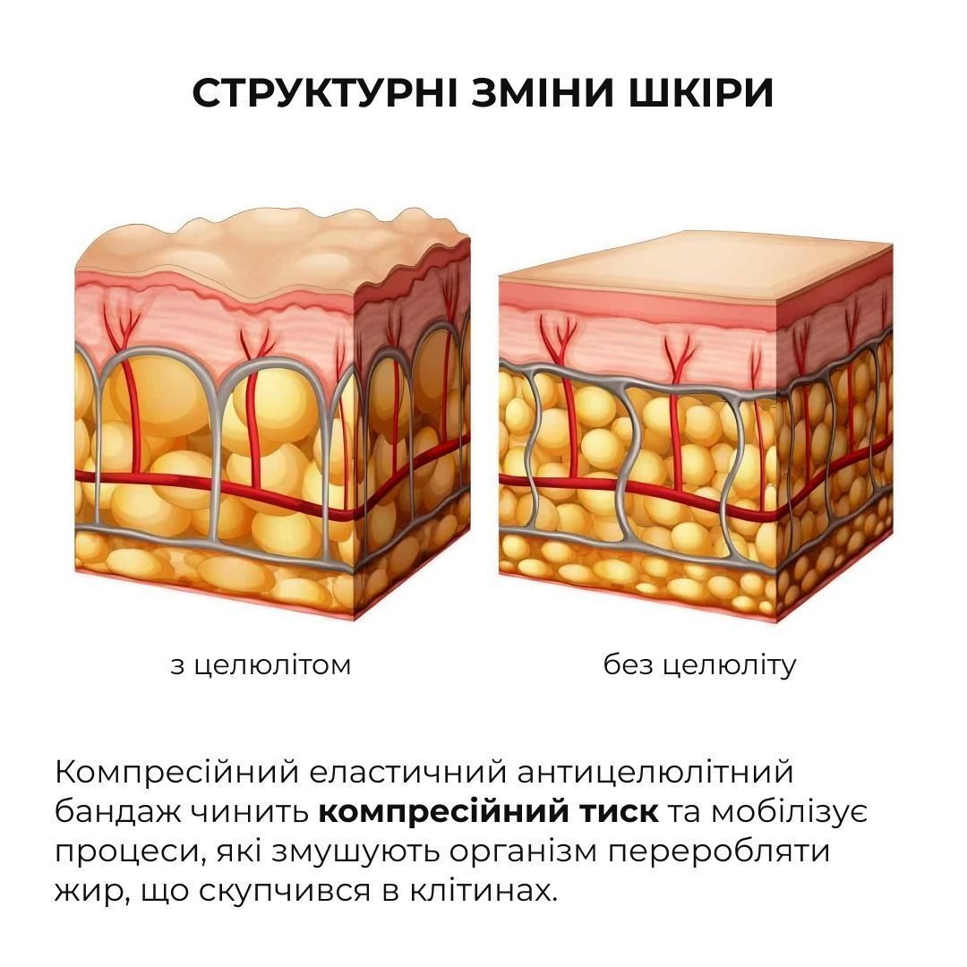 Набір антицелюлітних розігрівальних обгортань Hillary Heating Anti-Cellulite Wrap Set фото3