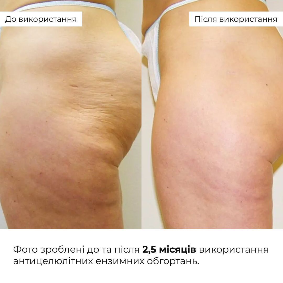 Набір антицелюлітних розігрівальних обгортань Hillary Heating Anti-Cellulite Wrap Set фото9